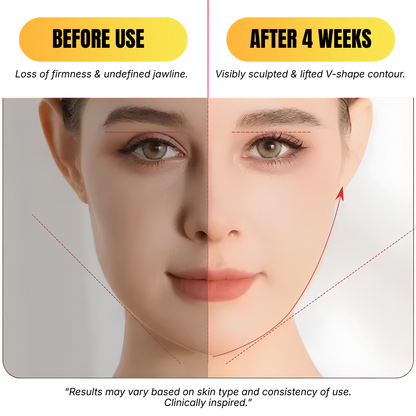 RF & Microcurrent V-Shape Facial Sculpting Roller