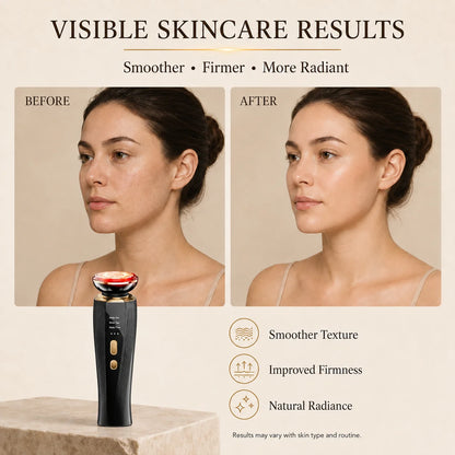 The Advanced Lift & Infuse Beauty Wand
